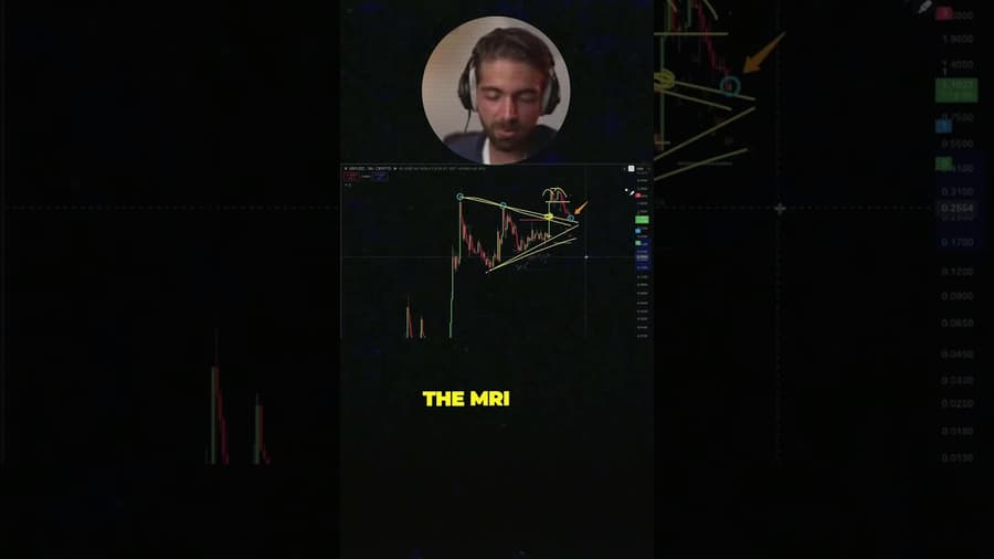 HOW CARL MADE $5 MILLION ON ONE XRP TRADE !!!!